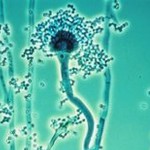 Aspergillus2